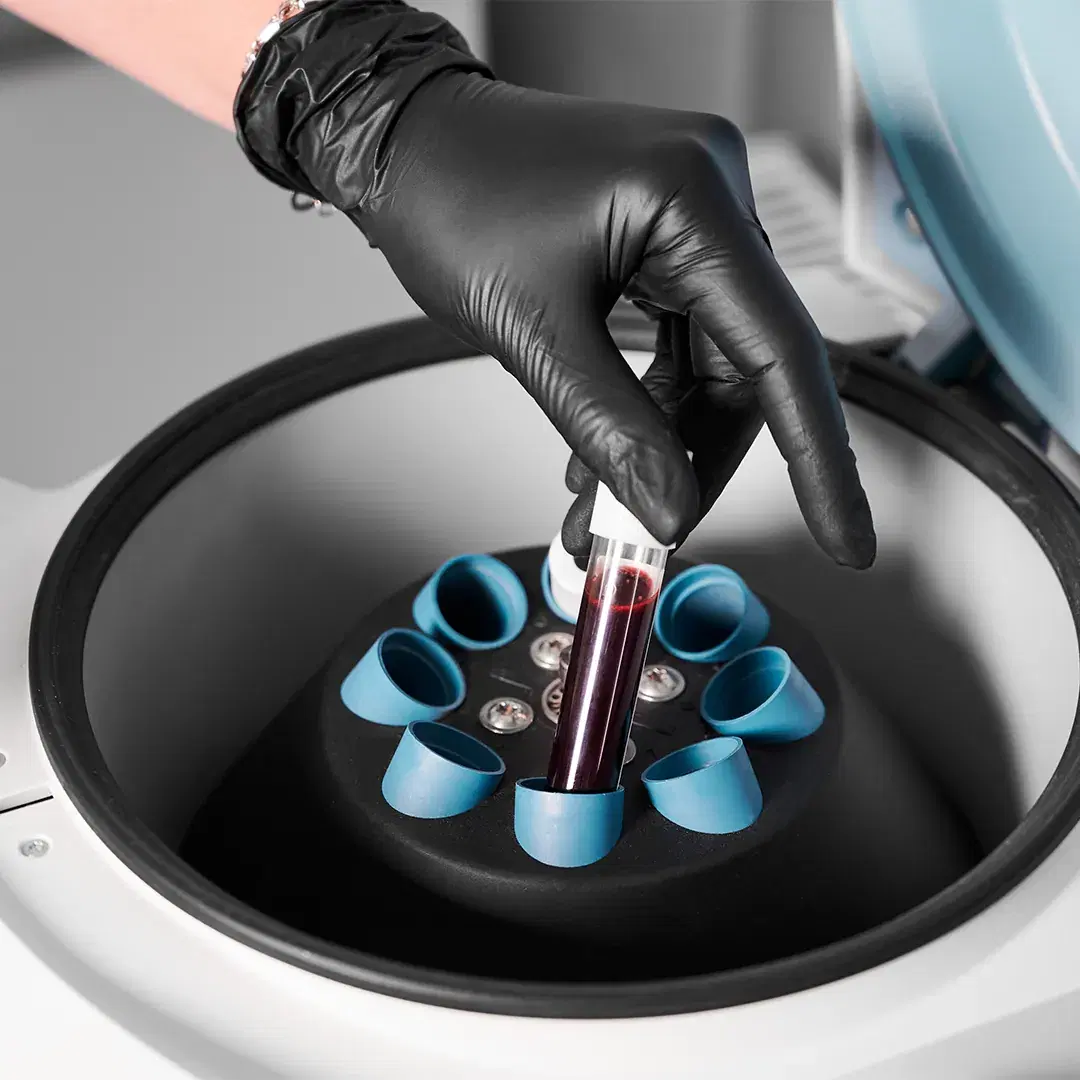 <h3><span style="color: rgb(247, 248, 248);">Blood Collection</span></h3>