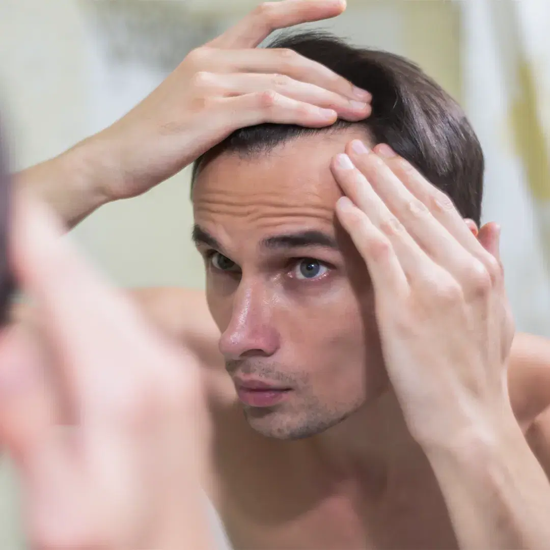 Diabetes Hair Loss: Why It Happens and What You Can Do