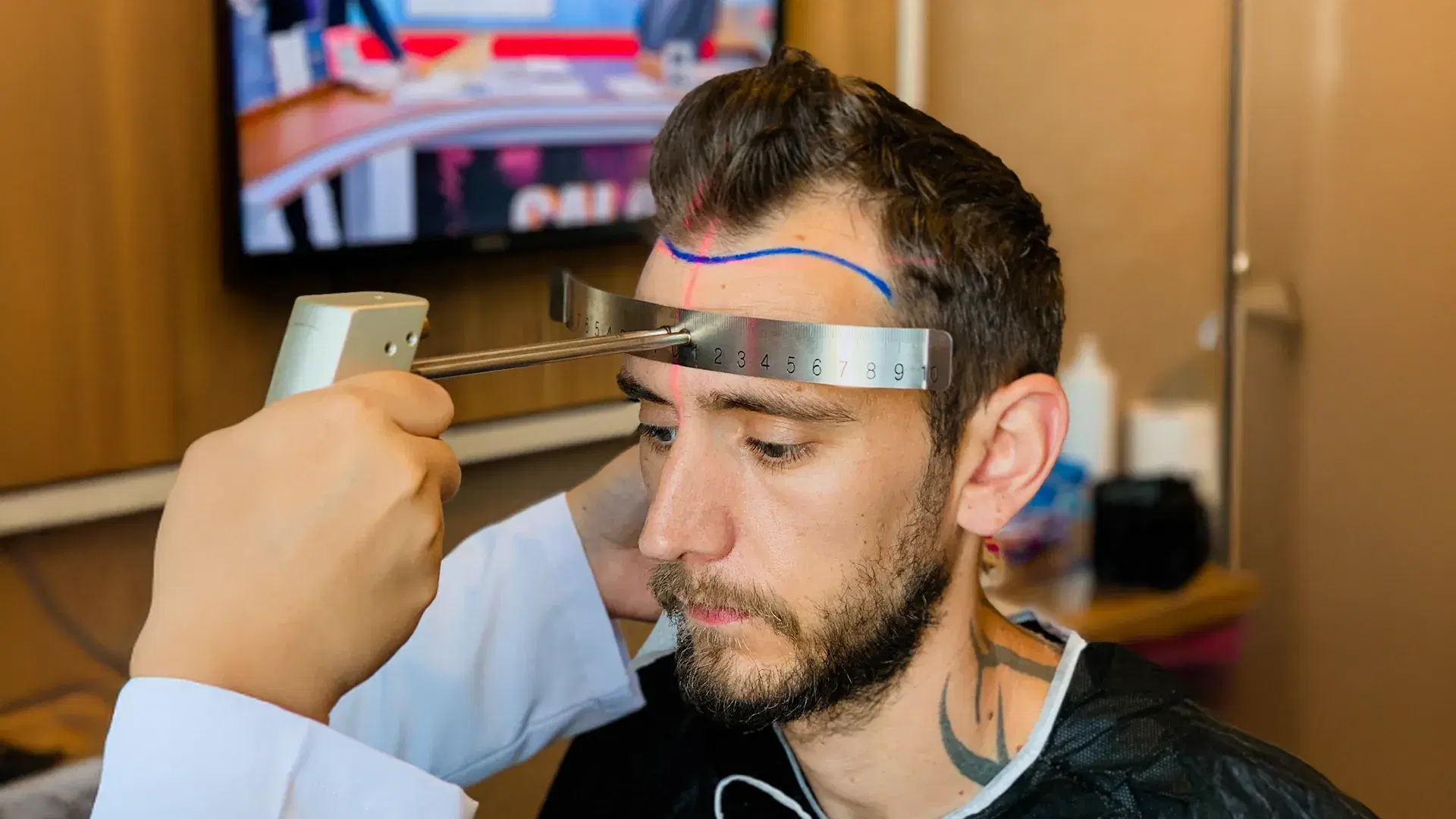 Laser Hairline Design