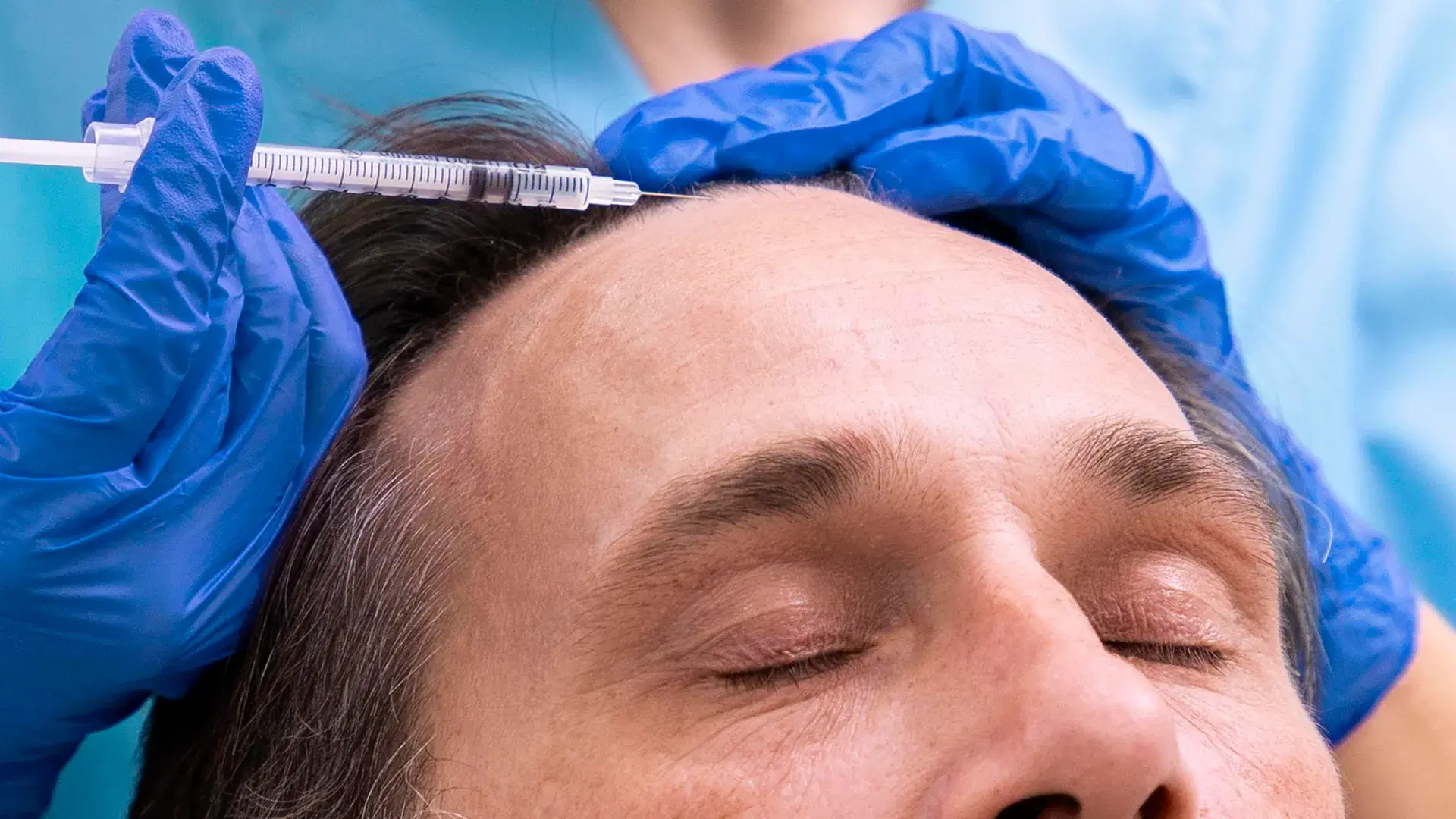 Mesotherapy (Injectable)