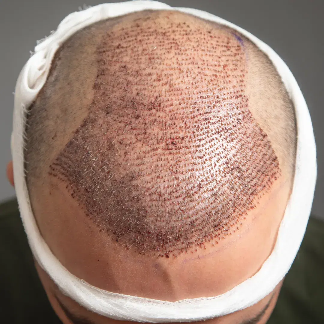 <h3><span style="color: rgb(247, 248, 248);">Recovery</span></h3>