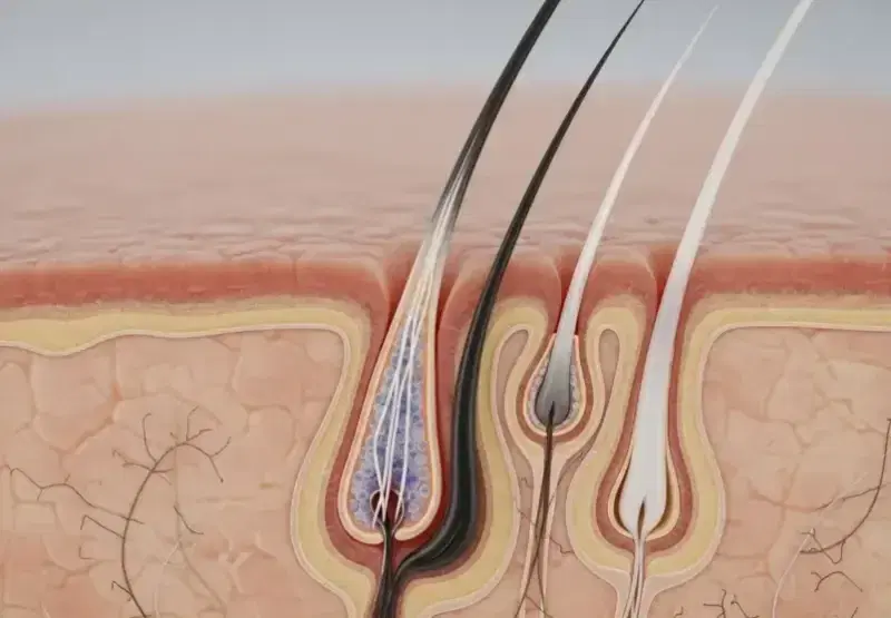Can Hair Follicles Die?