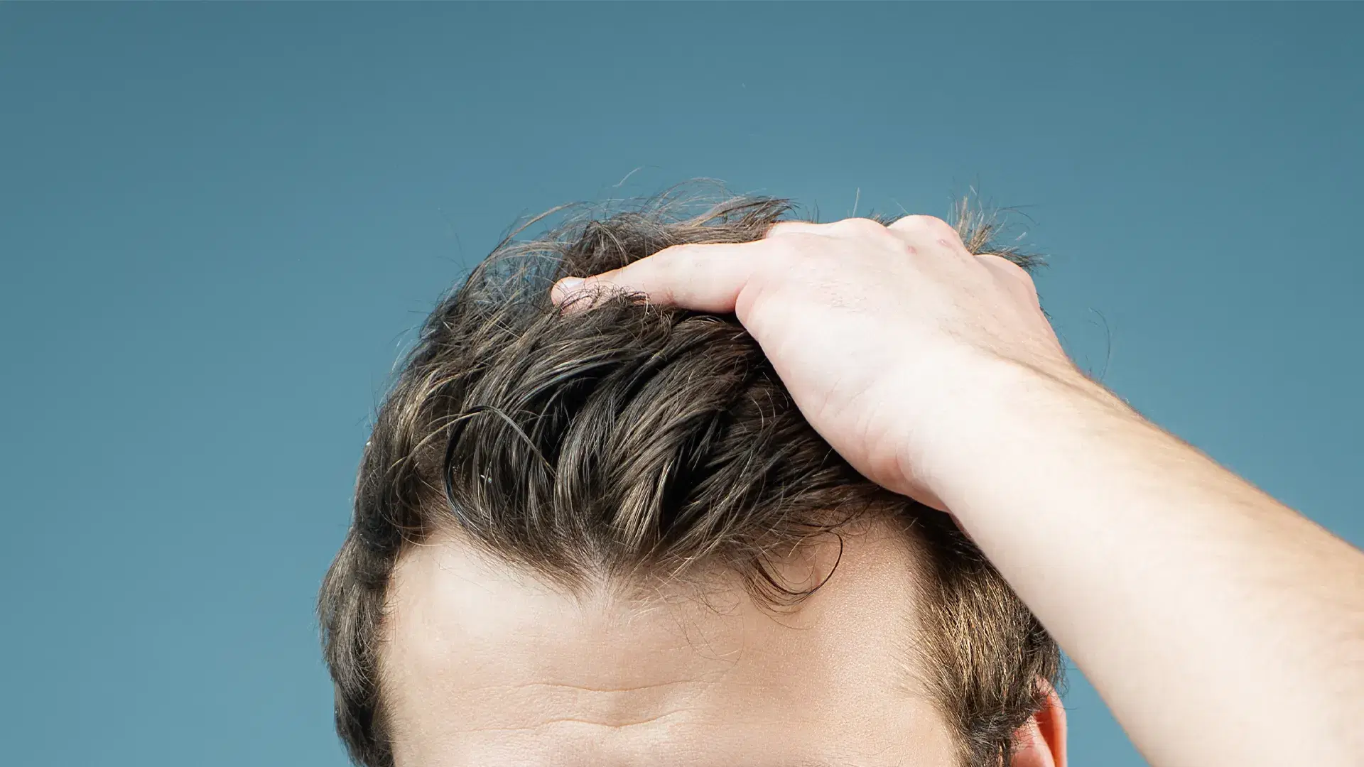 How to Increase Hair Density?