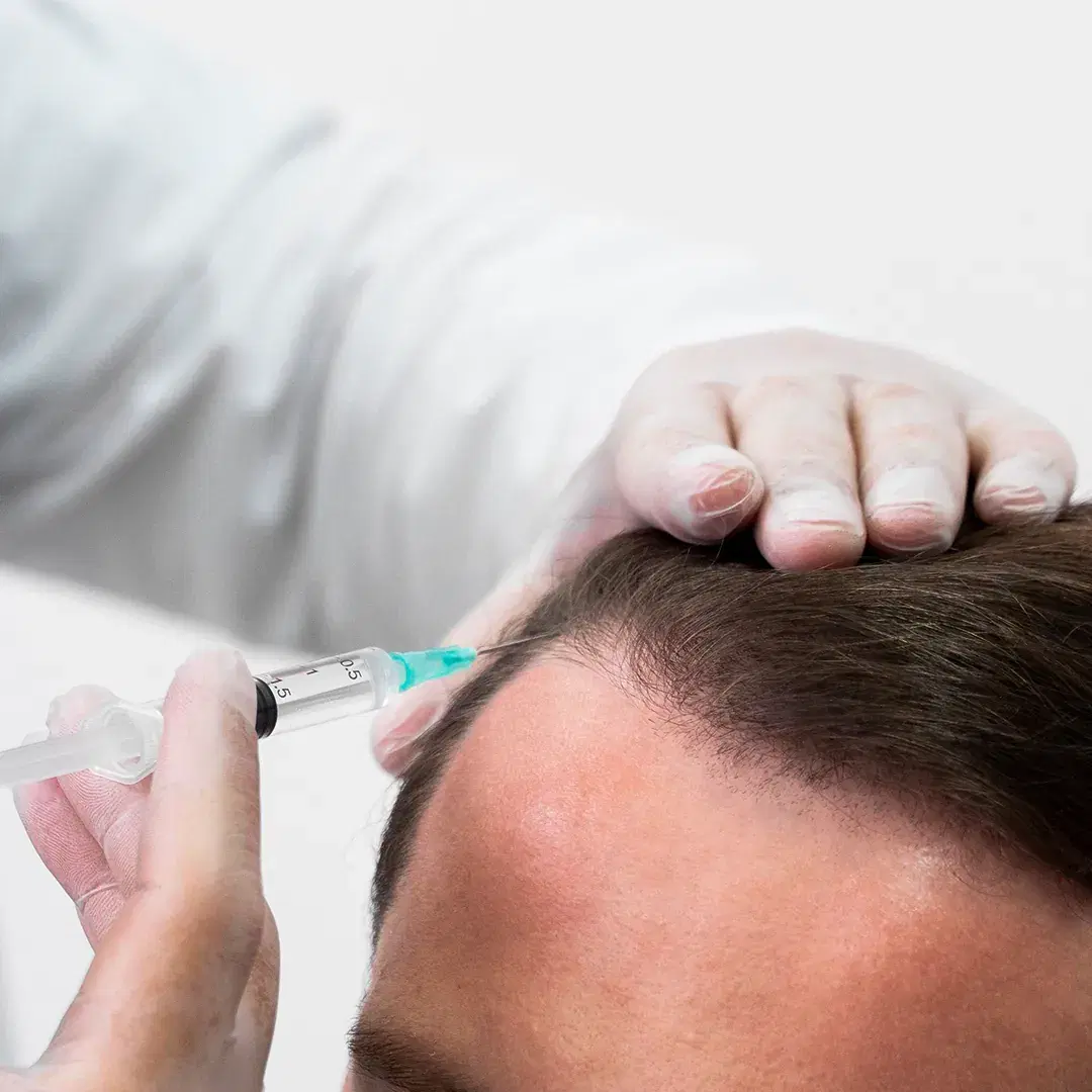 <h3><span style="color: rgb(247, 248, 248);">Injection Into the Scalp</span></h3>