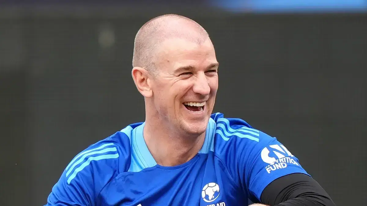 Joe Hart Hair Transplant