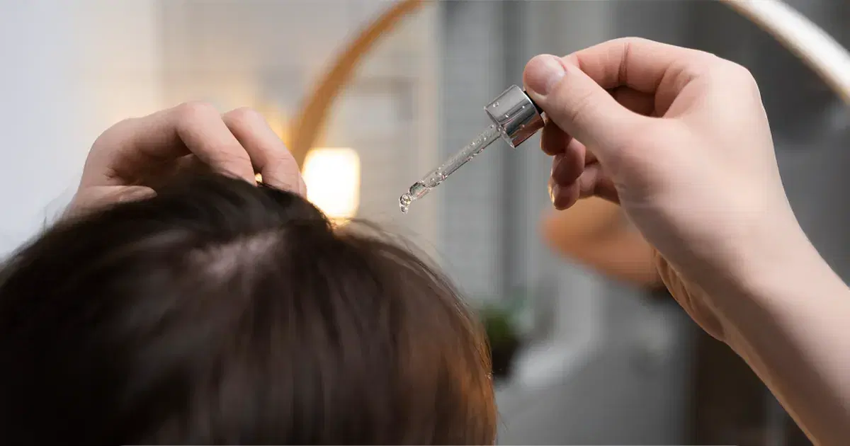 Minoxidil for Hair Loss: Does It Really Work?