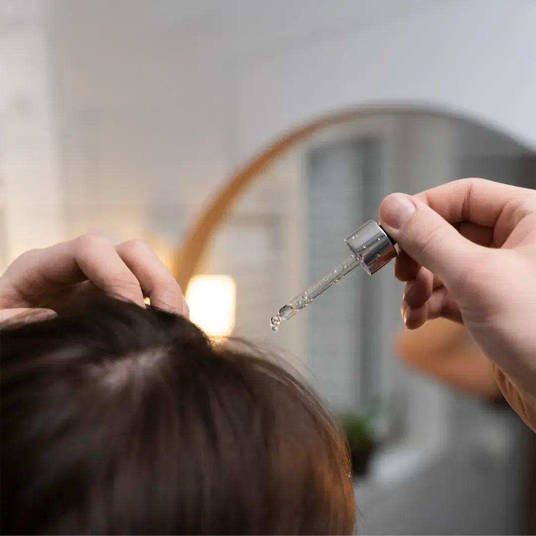 Minoxidil for Hair Loss: Does It Really Work?