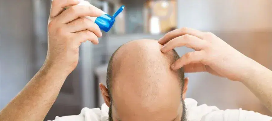 Panthenol Spray After Hair Transplant: When Should You Start?