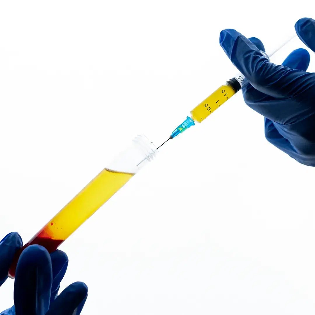 <h3><span style="color: rgb(247, 248, 248);"><strong>Plasma Separation</strong></span></h3>