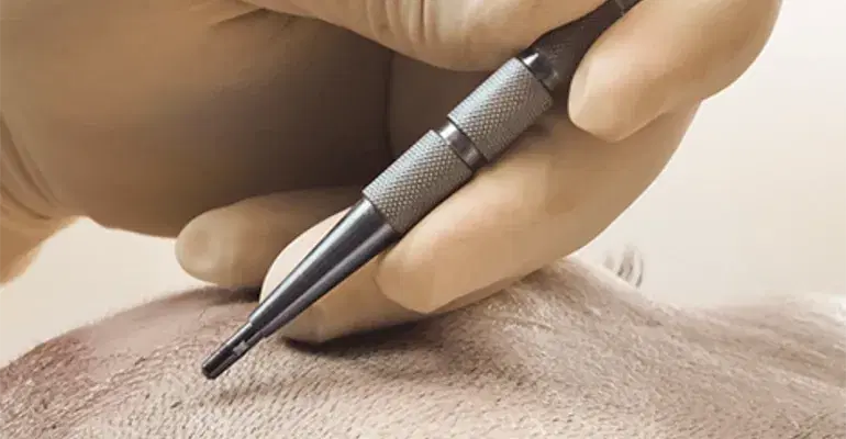 Sapphire Blades Used in Sapphire FUE
