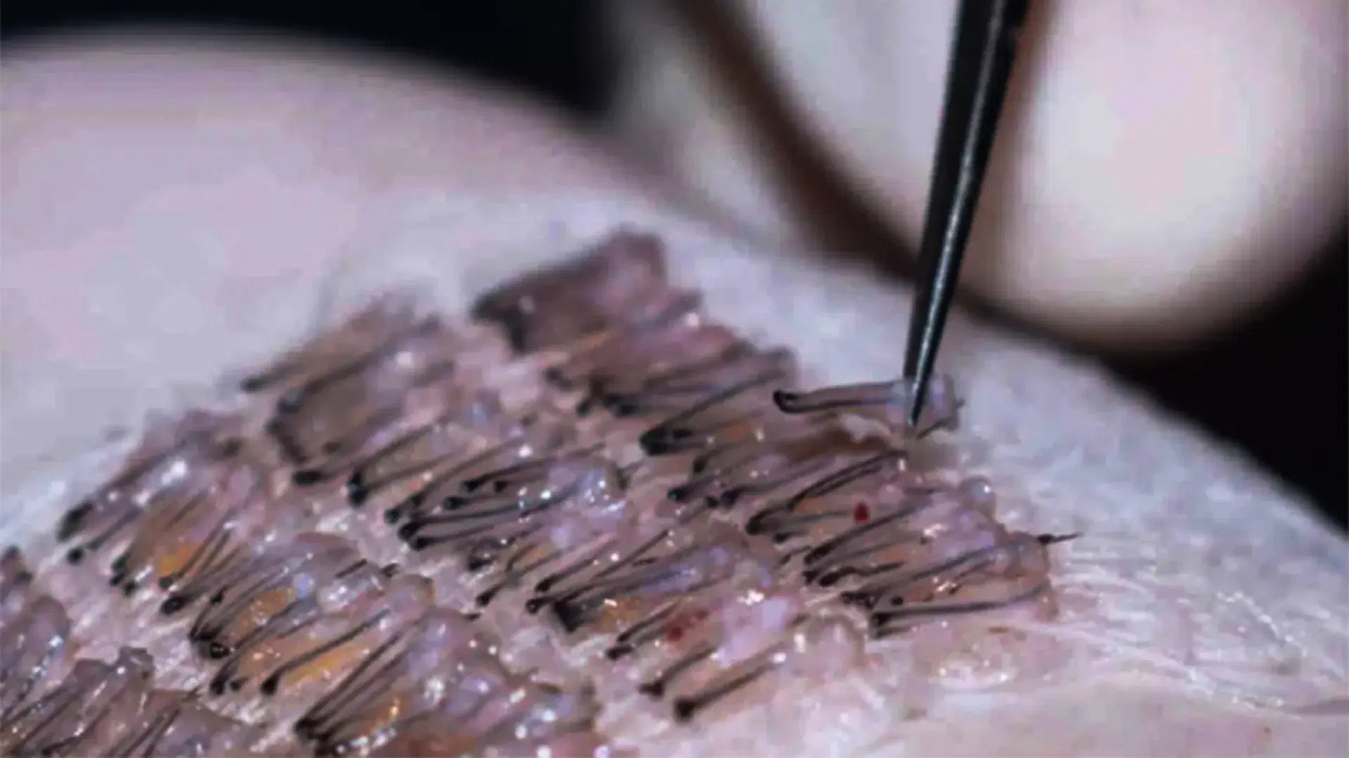 Structure of the Hair Follicle