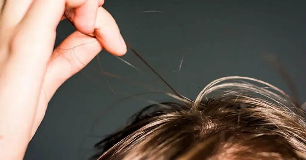 Trichotillomania