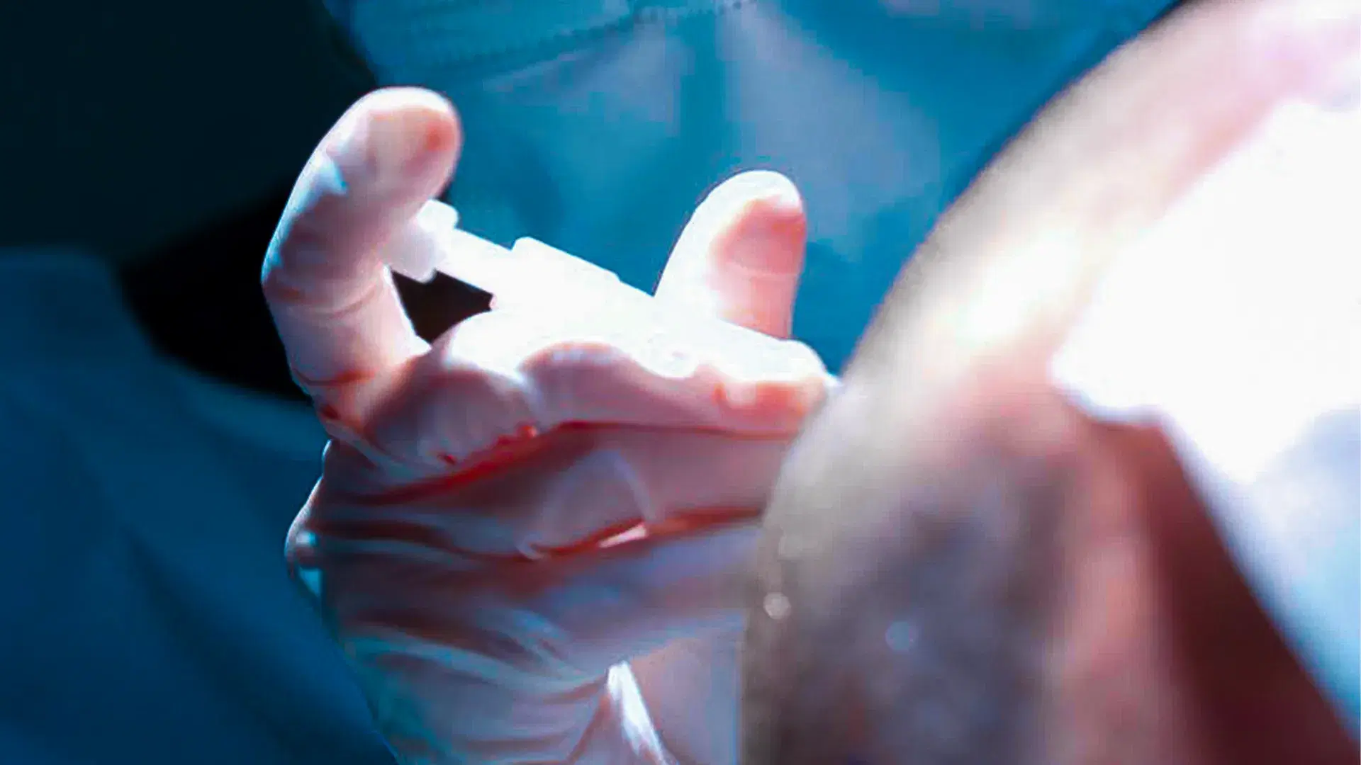 Who Is a Good Candidate for a Hair Transplant?