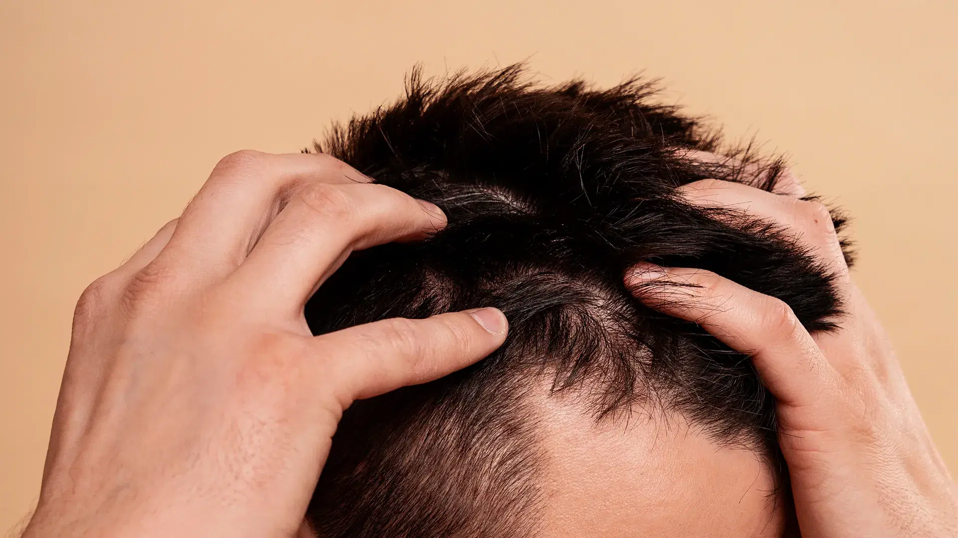 What Is High-Density Hair