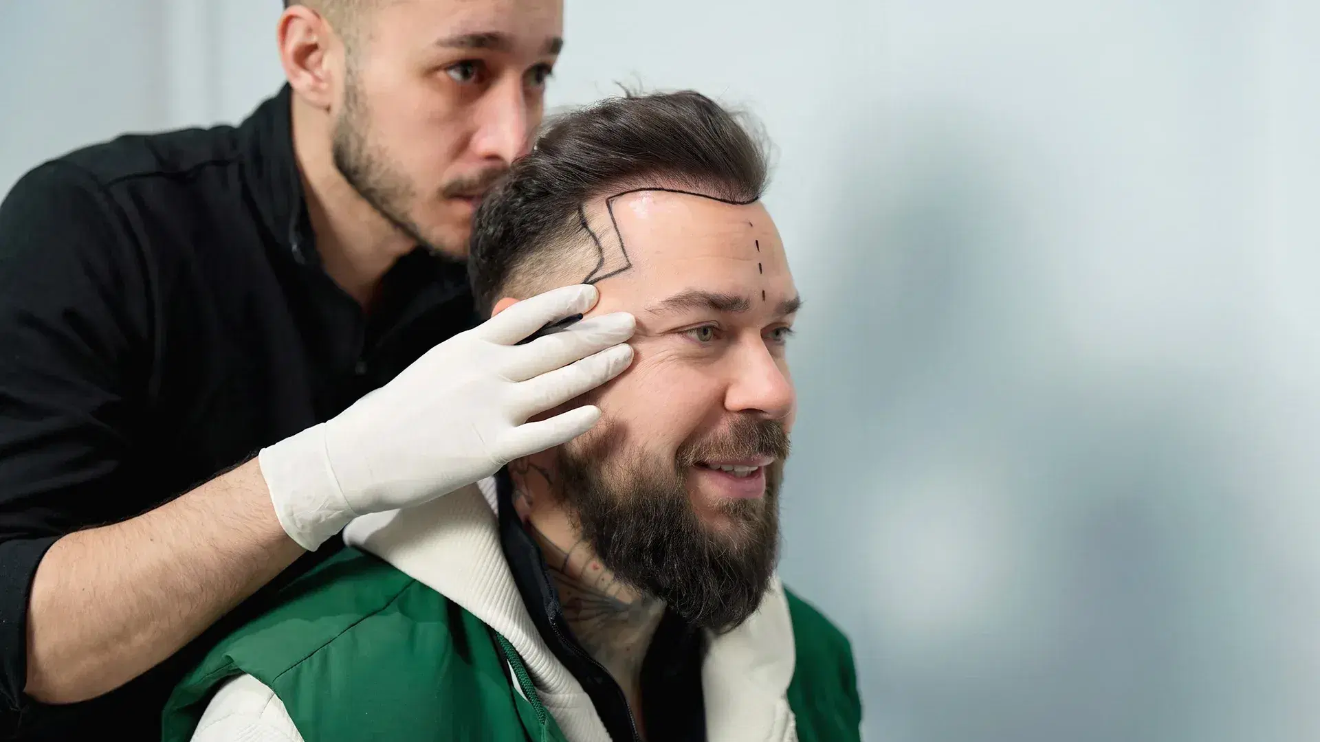 Hair Transplant Turkey