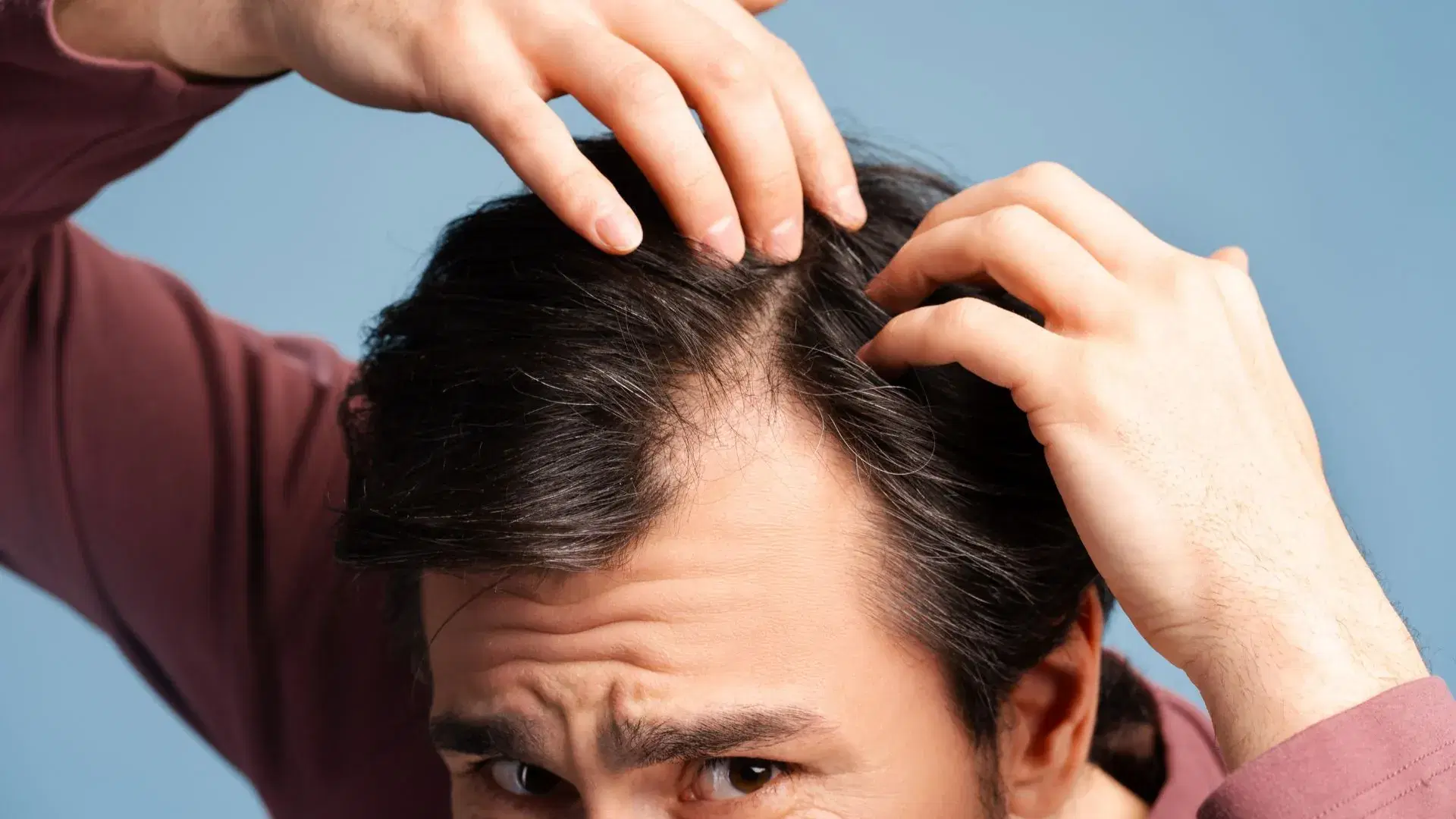 How to Stop Hair Loss?