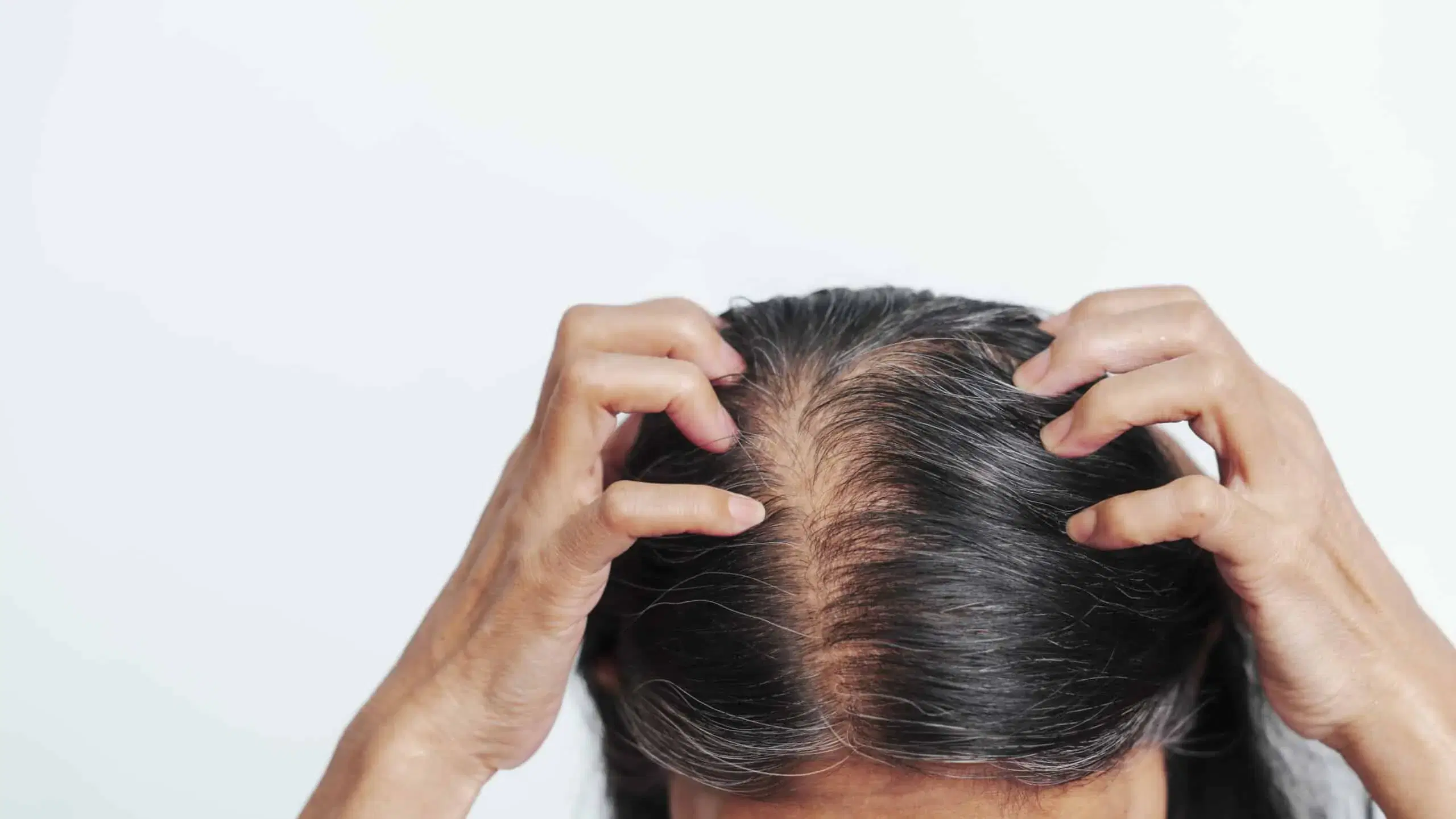 Can Hard Water Cause Hair Loss? Effects on Hair, Scalp, and Breakage