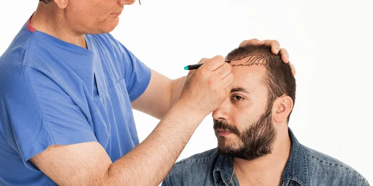 Best Time of Year for a Hair Transplant