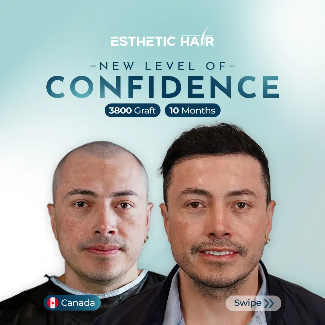 combined-2