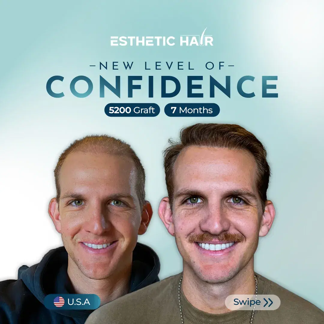 combined-4