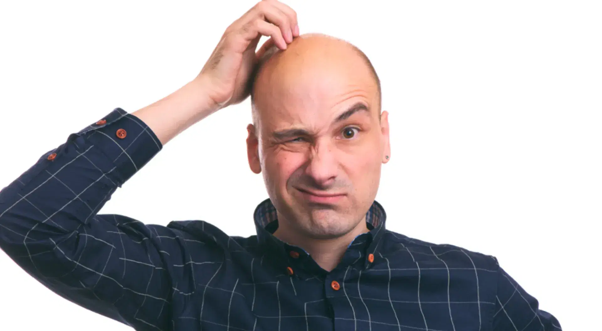 Am I Too Bald for a Hair Transplant?