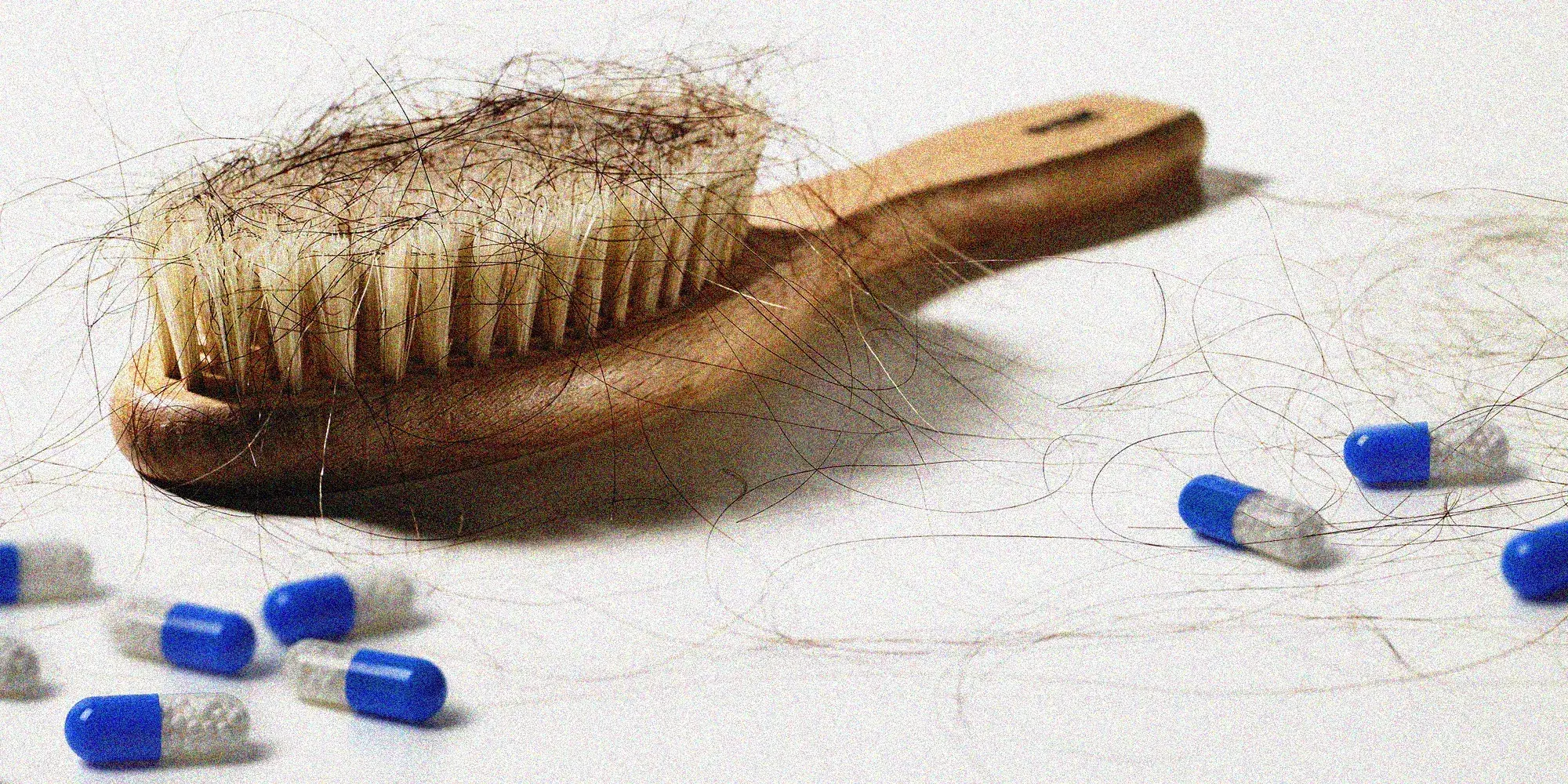 Best Vitamins for Hair Loss: Which Nutrients Actually Help Hair Growth?