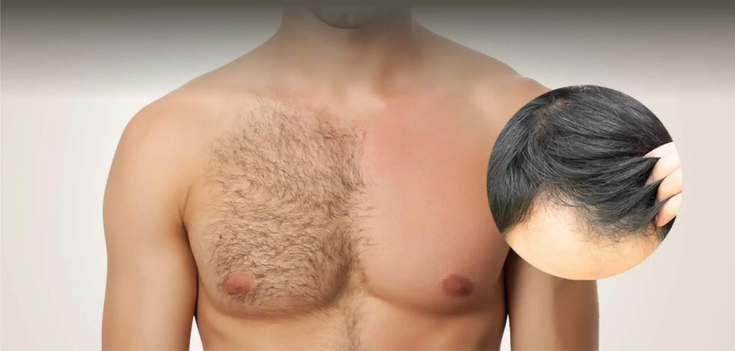 Body Hair Transplant Donor Sites: Clinical Guide