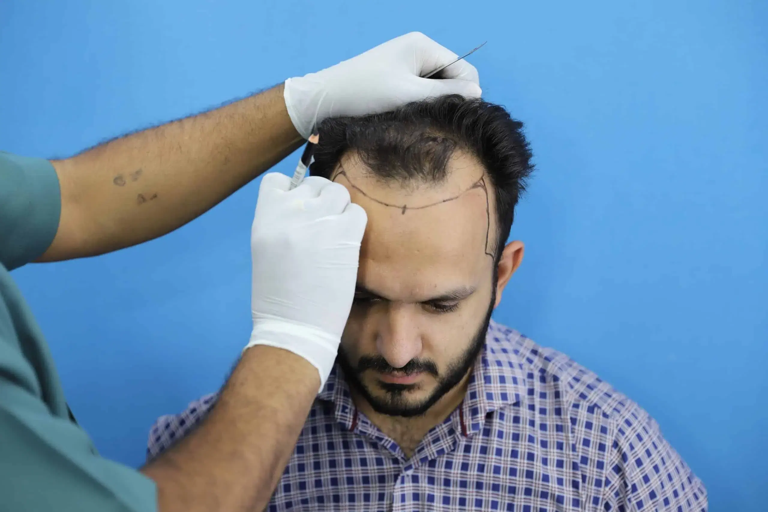 Does Long-Distance Travel Affect Hair Recovery?