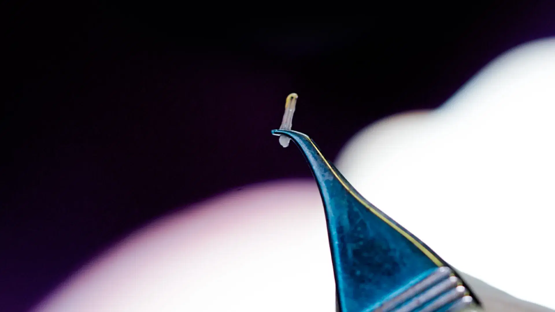 Follicle Extraction Without Full Shaving