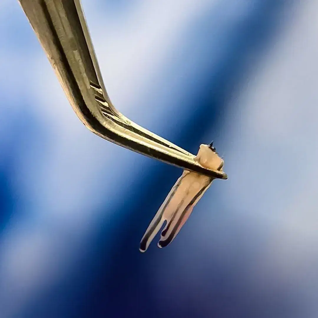 Grafts for Hair Transplant: How Many Do You Really Need?