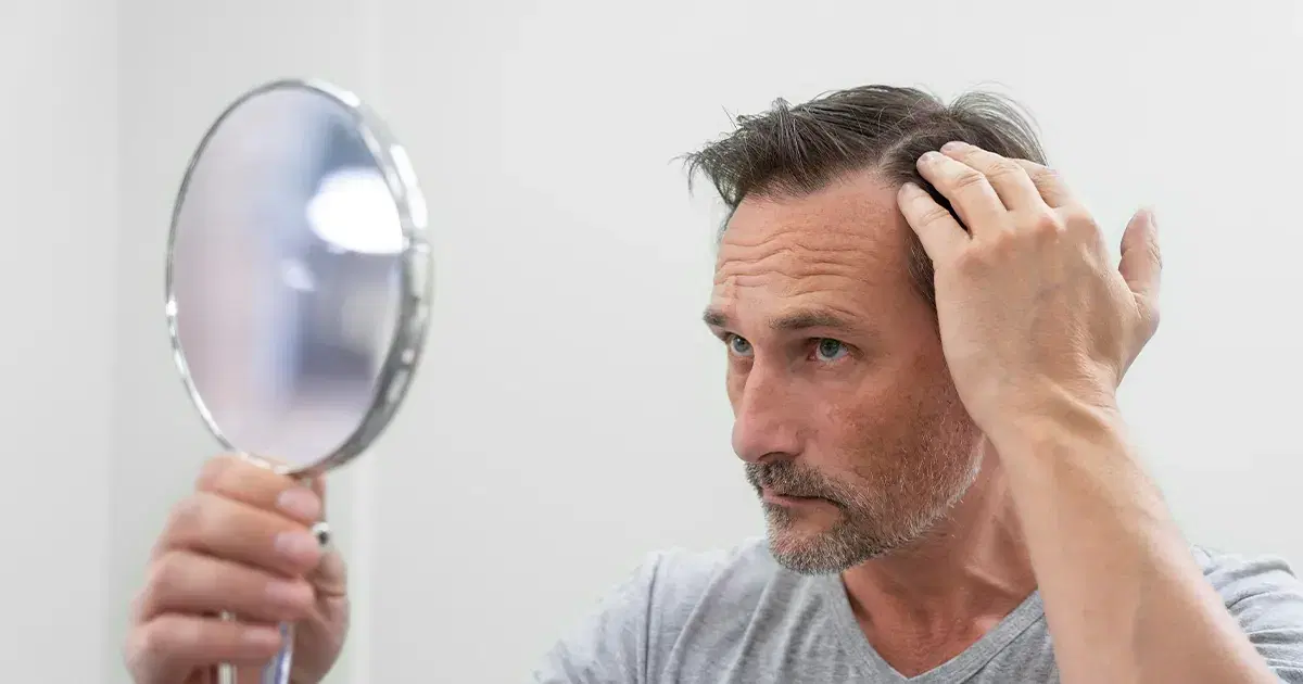 Hair Density Guide How to Increase and Prevent Hair Loss