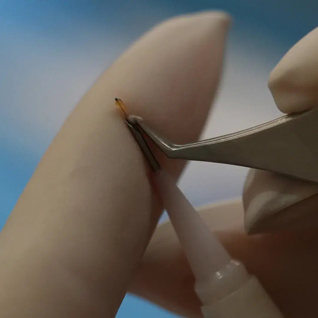 Hair Grafts: Cost, Numbers, and Results in Transplants