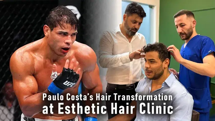 Paulo Costa's Hair Transplant