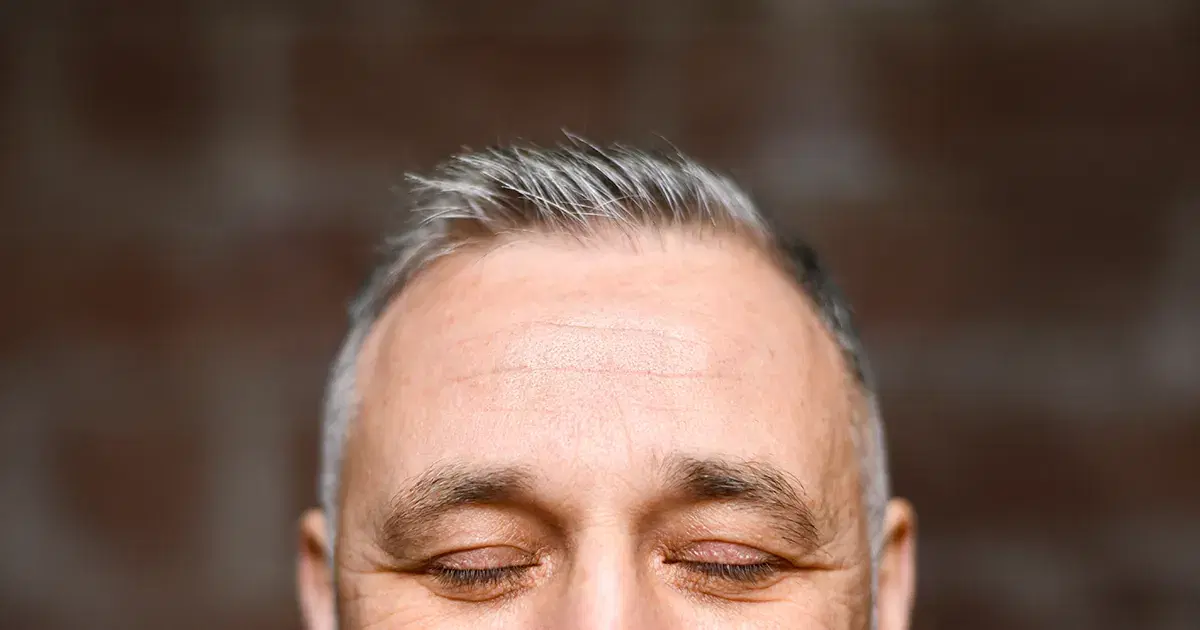 Receding Hairline: Causes, Styles, and Solutions