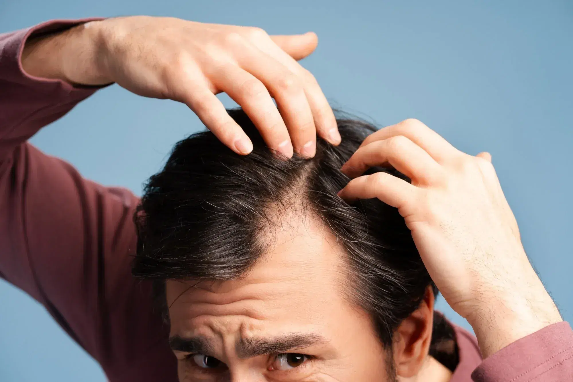 Signs of Going Bald: Early Symptoms of Hair Loss