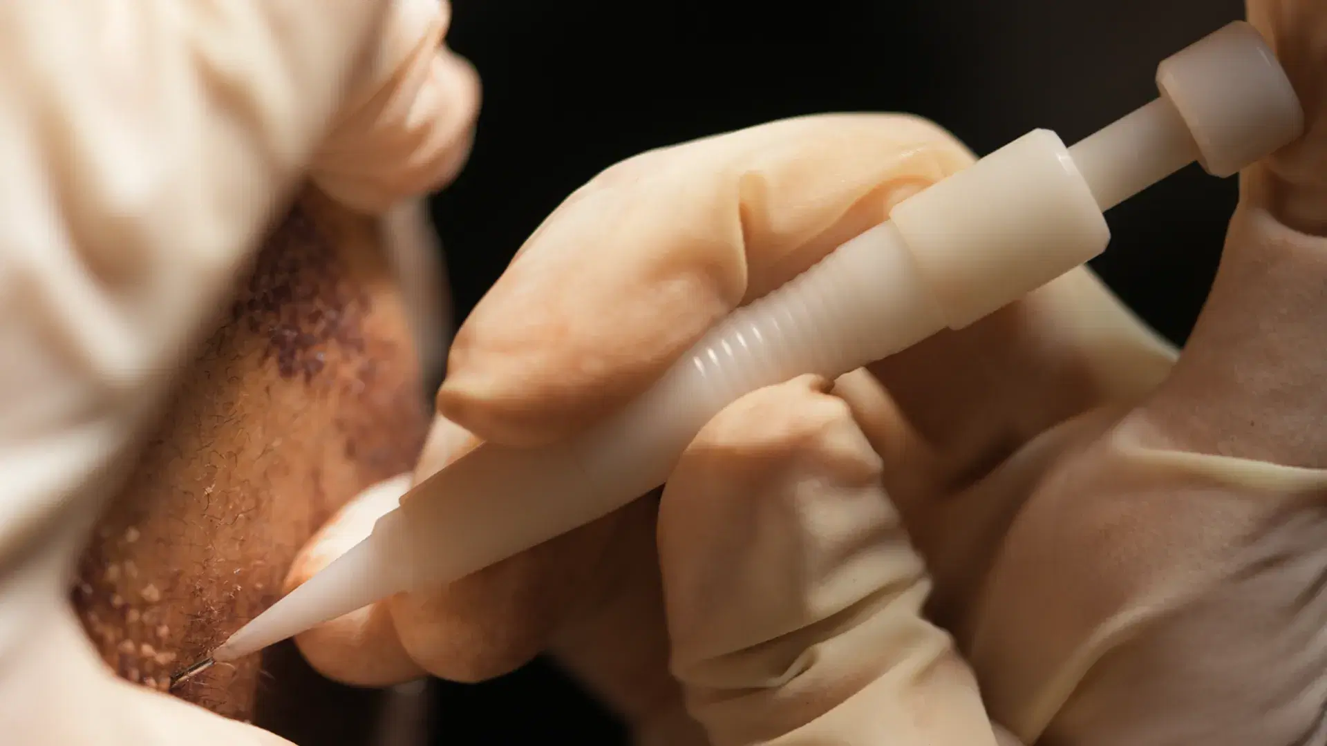 Treatments at Esthetic Hair Clinic