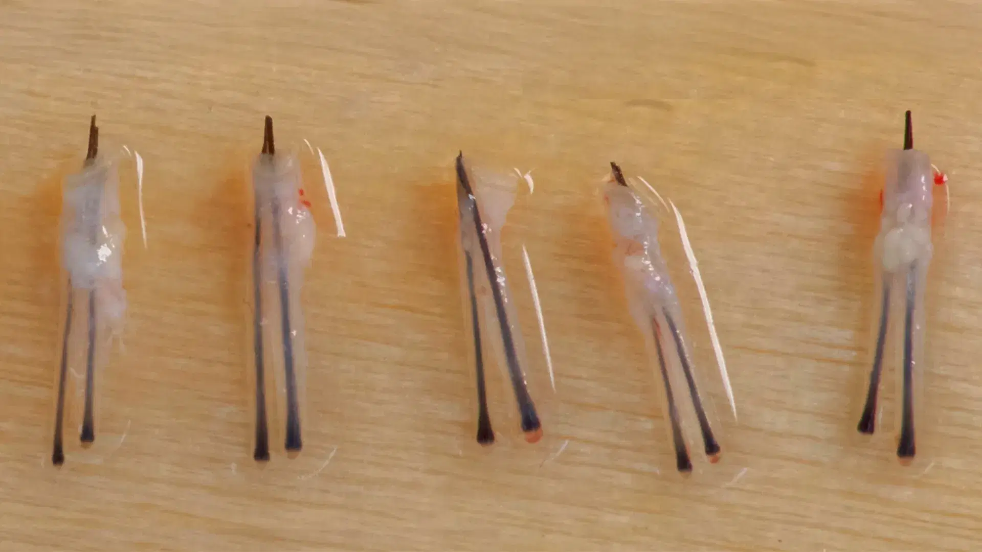 What Are Grafts in Hair Transplants?
