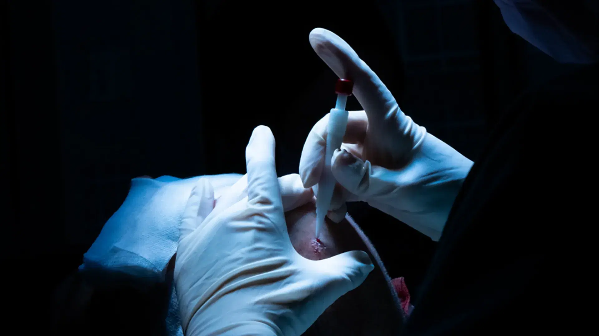 Advantages of Using the Pen