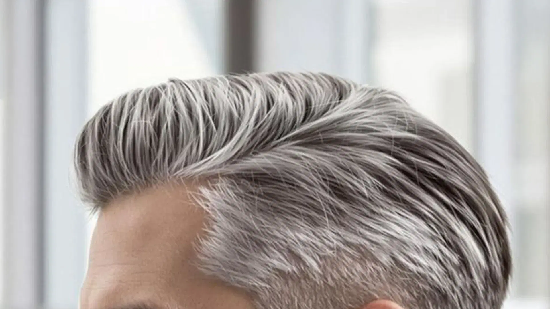 When Does the Hairline Mature?