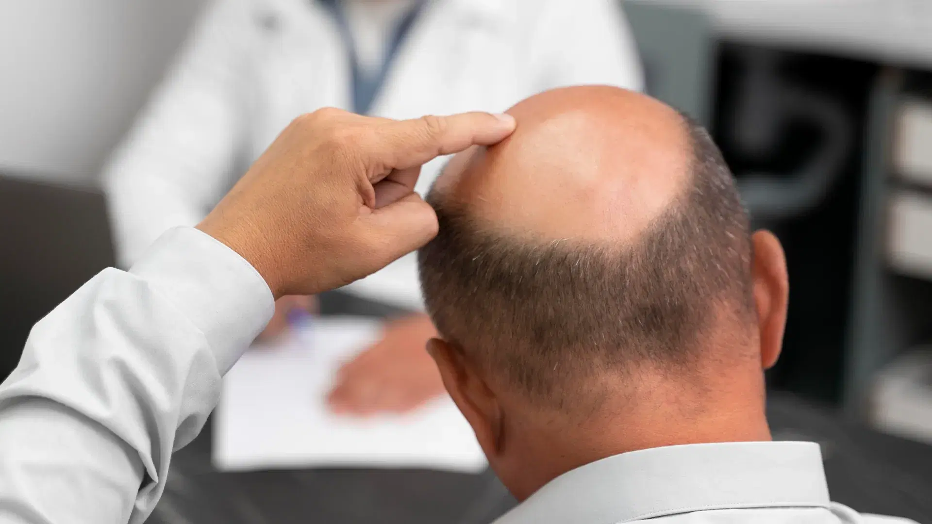 Who Is a Good Candidate for Sapphire FUE?