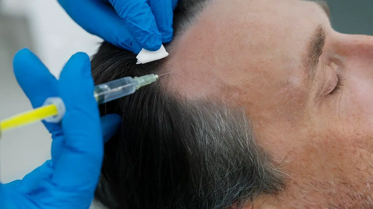 Stem Cell Therapy