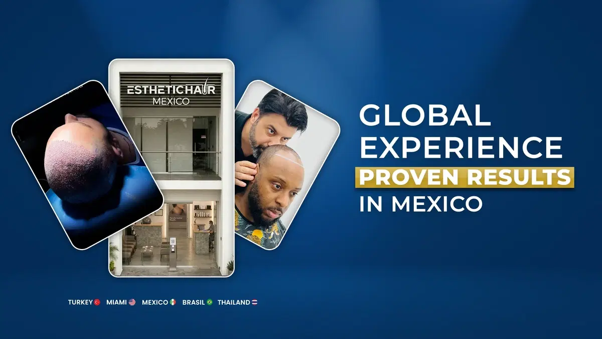 hair transplant mexico