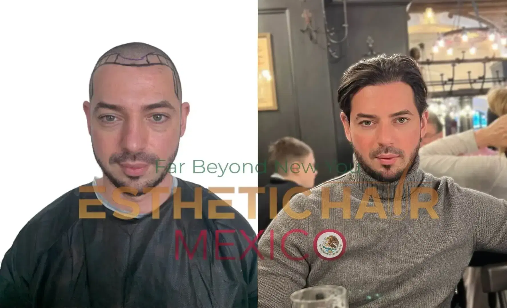 ¿La creatina causa pérdida de cabello? Mitos vs. realidades