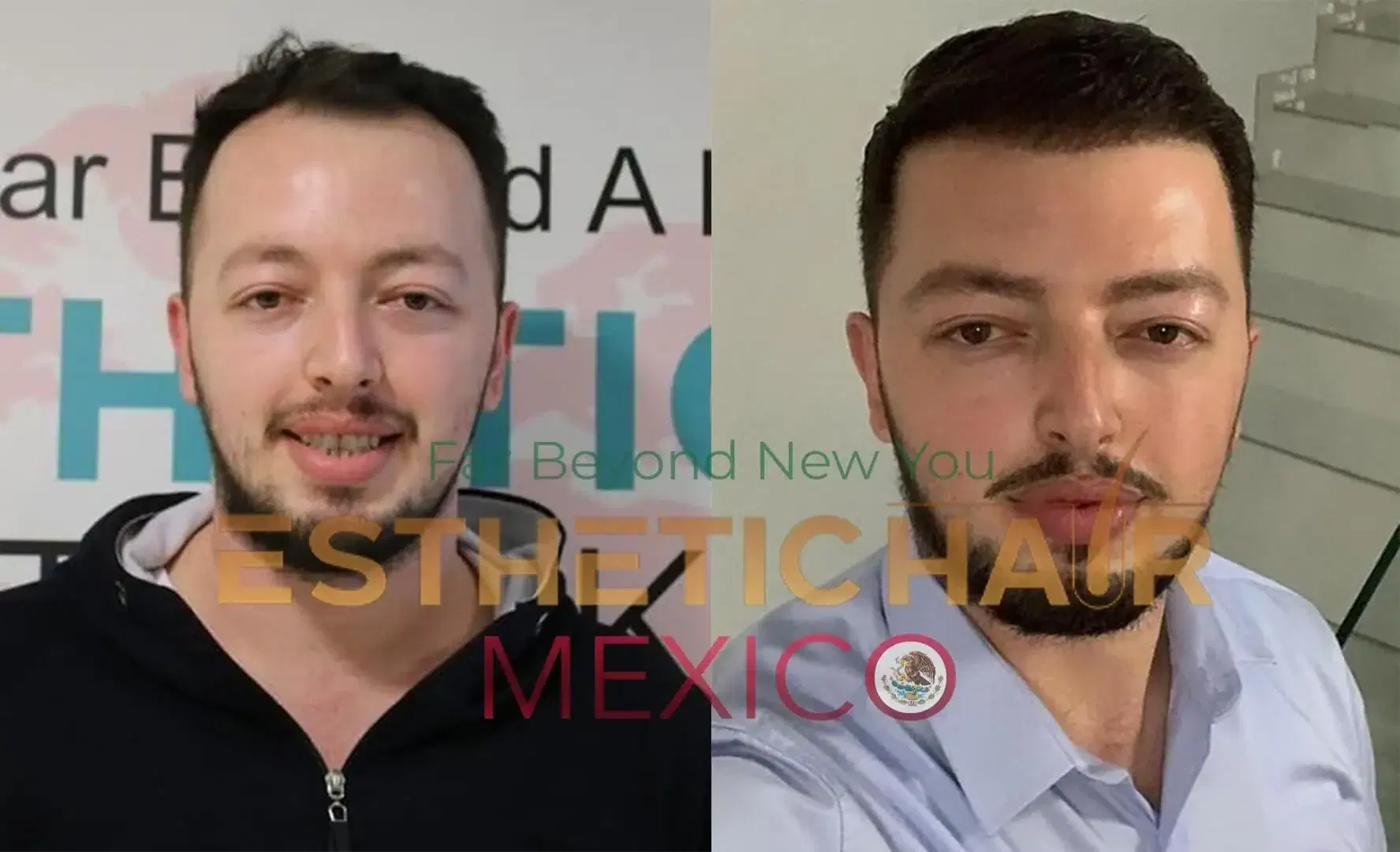 Sobre nosotros - Esthetic Hair