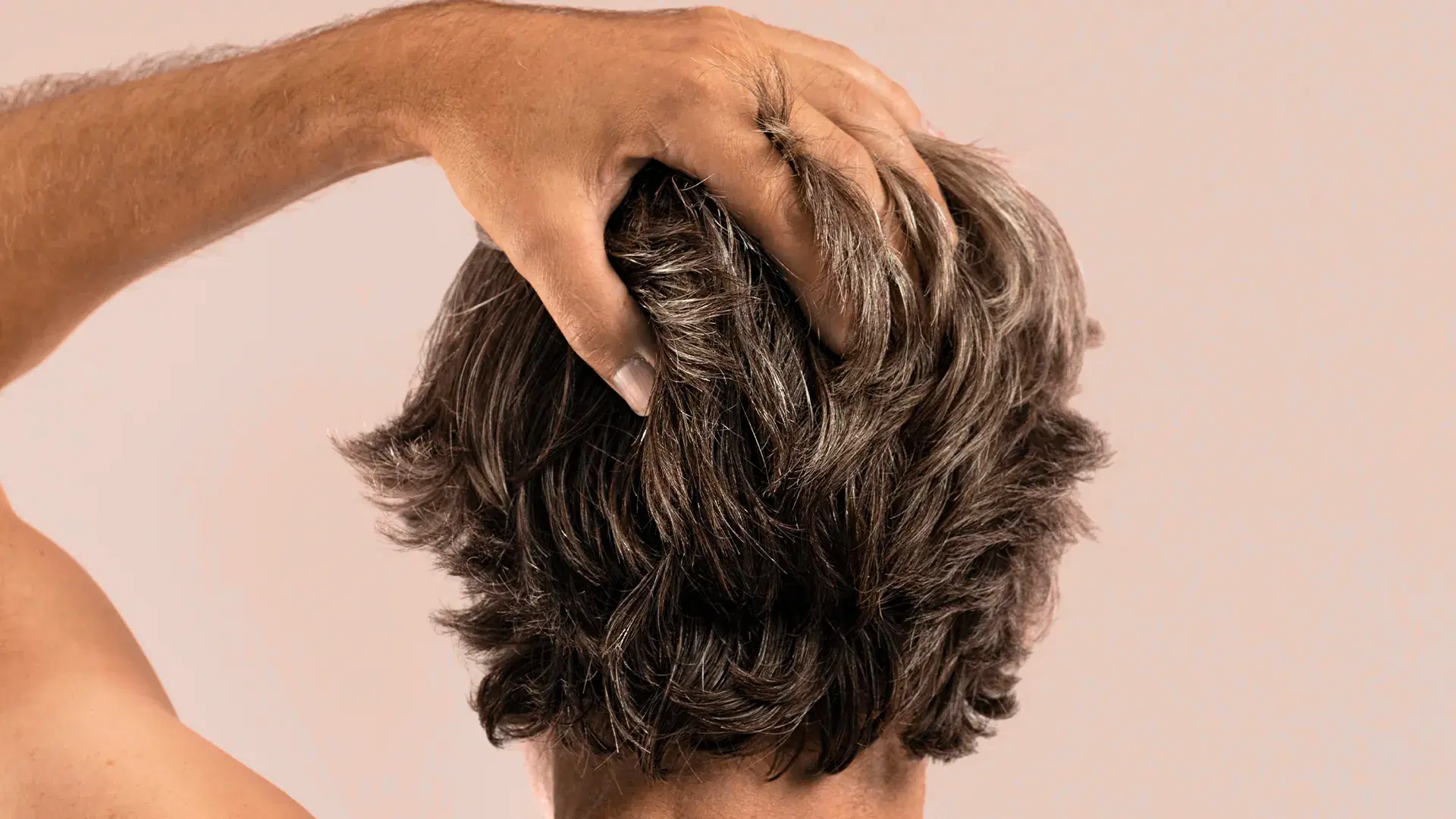 ¿Por qué elegir la terapia PRP para el cabello en México?