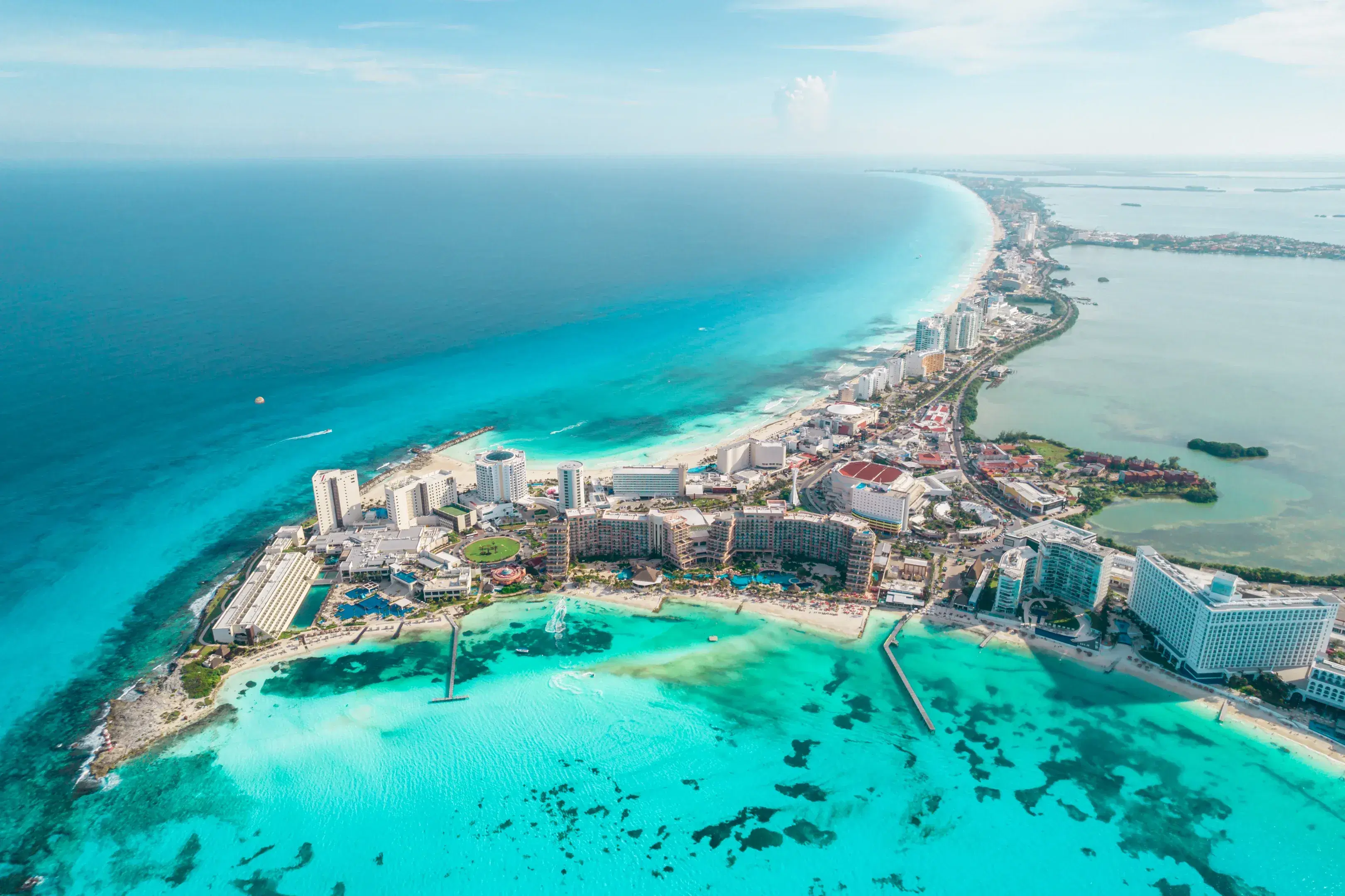 DHI Hair Transplant in Mexico Cancún