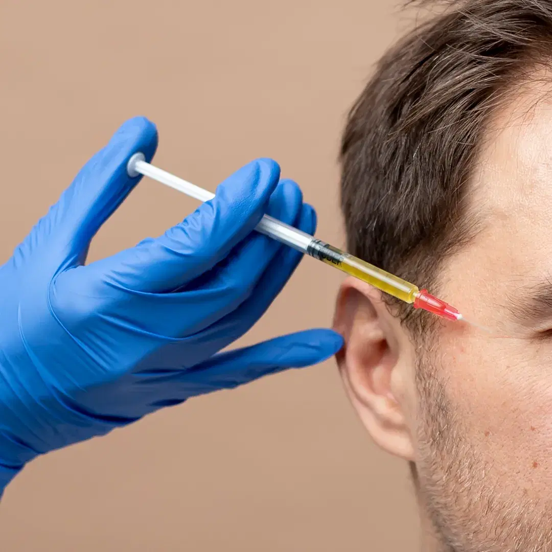 ¿Qué es la Terapia PRP?