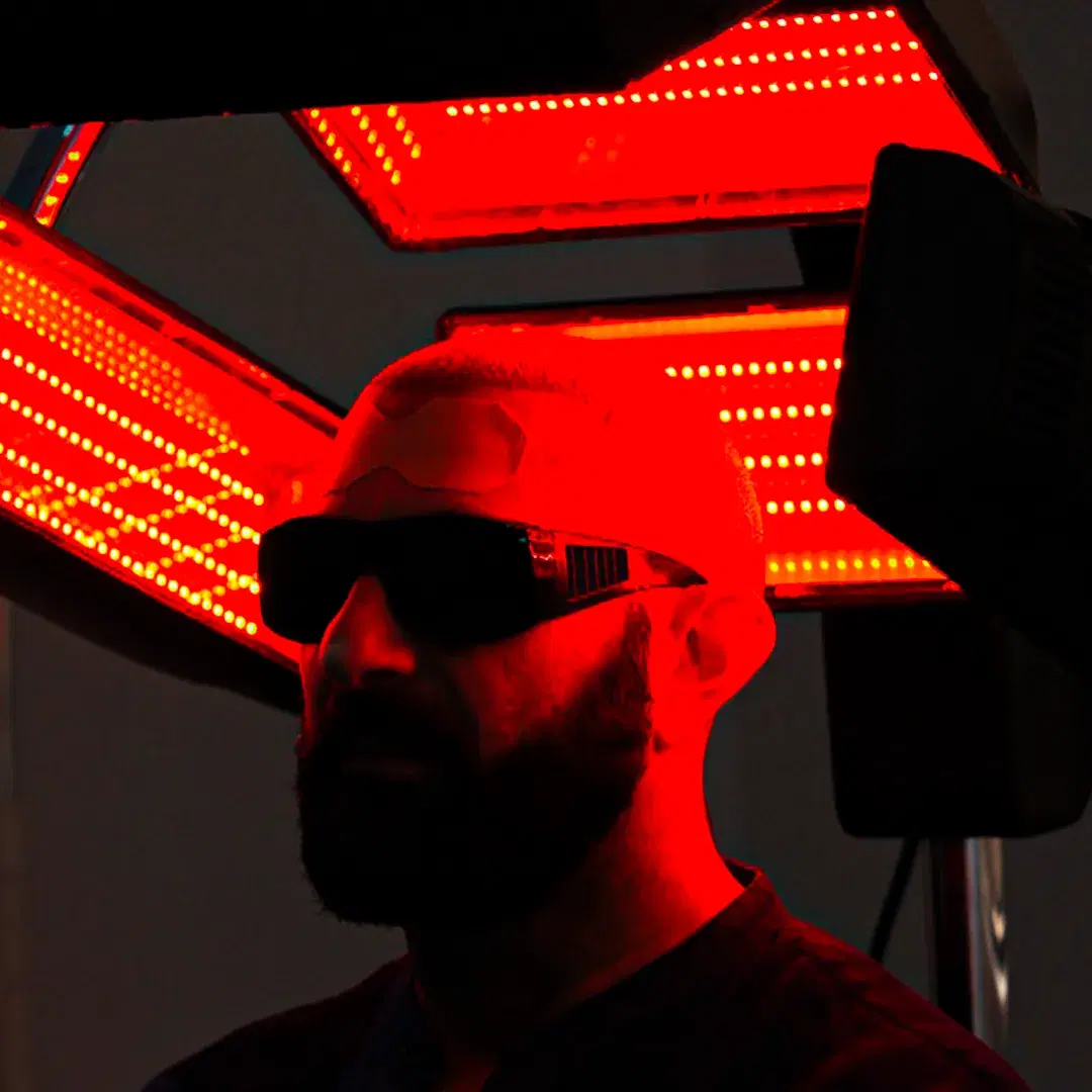 Terapia de Luz Roja para la Pérdida de Cabello