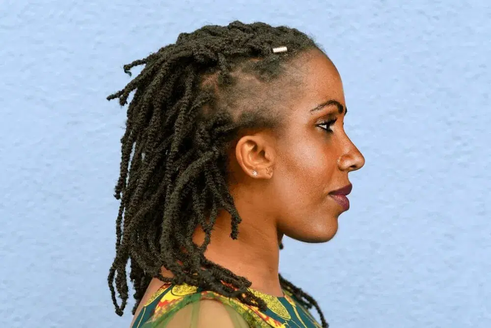 Traction Alopecia in Black Women