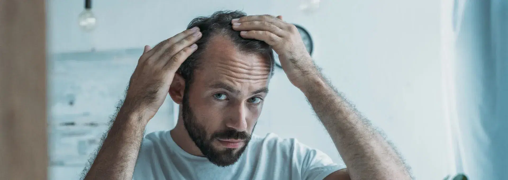 Hair Loss